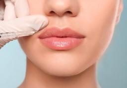 Enhance Your Beauty with Lip Fillers