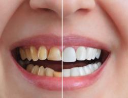 Transform Your Smile with Dental Cosmetics