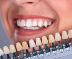 Dental Implants: The Path to a Beautiful Smile