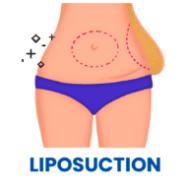 Why Coose Liposuction