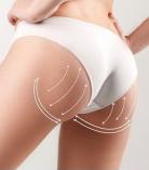 Buttock Lift treatment Northcliff Non Surgical Face Lifts 8 _small
