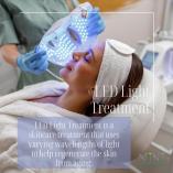 Get 20% OFF all Microneedling treatments, add on an LED treatment Northcliff Non Surgical Face Lifts _small