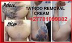 BOTCHO CREAM & YODI PILLS FOR Manhood, HIPS, BUMS, & LEGS ENLARGEMENT JOHANNESBURG Roodepoort CBD Tattoo Removal