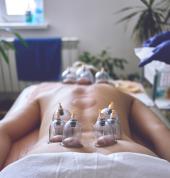 Cupping Therapy