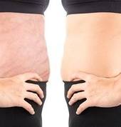 Mels Skin Clinic | Tattoo Removal | Microblading Cape Town Brackenfell Tattoo Removal 3_small