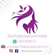 Tattoo removal Cape Town