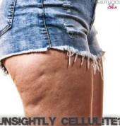 Beautilicious Med Spa Winchester Hills Exfoliation 2_small