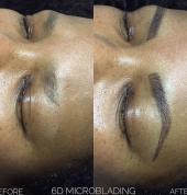 Microblading