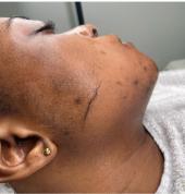 Glam Studio SA Vanderbijlpark Aesthetic Clinics 2_small