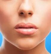 Aesthetic Makeover Studio Umhlanga Rocks Botox 3_small