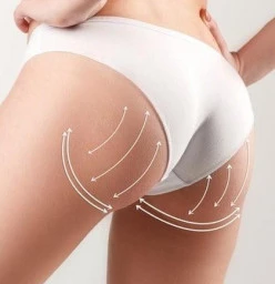 Buttock Lift treatment Northcliff Non Surgical Face Lifts